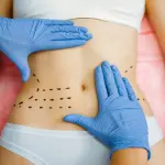 Chirurgia plastica ed estetica cosa sapere