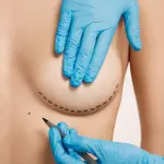 Mastoplastica additiva: che cos’è,<br>come funziona e indicazioni per<br>l’intervento di aumento del seno