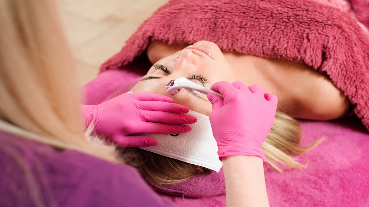 Needling: cosa è e come funziona