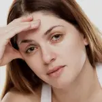 Le occhiaie cause e rimedi