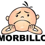 Come alleviare i sintomi del morbillo e l'uso della maglia rossa