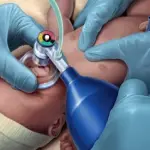 Distress respiratorio nei neonati: le cause