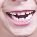 Crescita dei denti nei bambini: problemi e soluzioni