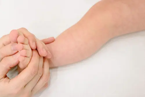 Acaro dermatite nel bambino: come riconoscerla
