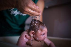 Zika: il virus che danneggia i neonati
